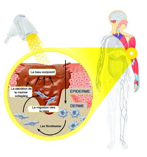 BIOPTRON_FlipChart_page14_fr.png